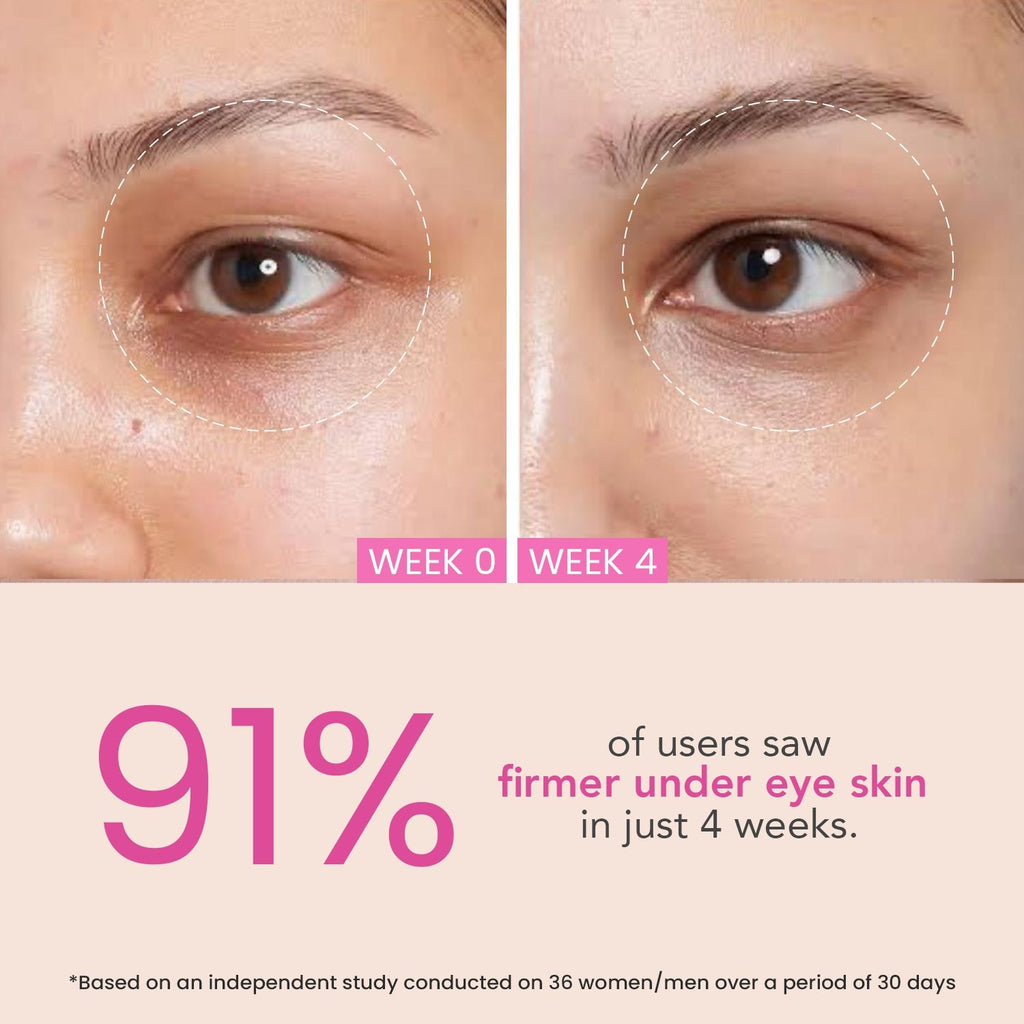 Eye Circle Brightening & Whitening Under Eye Cream