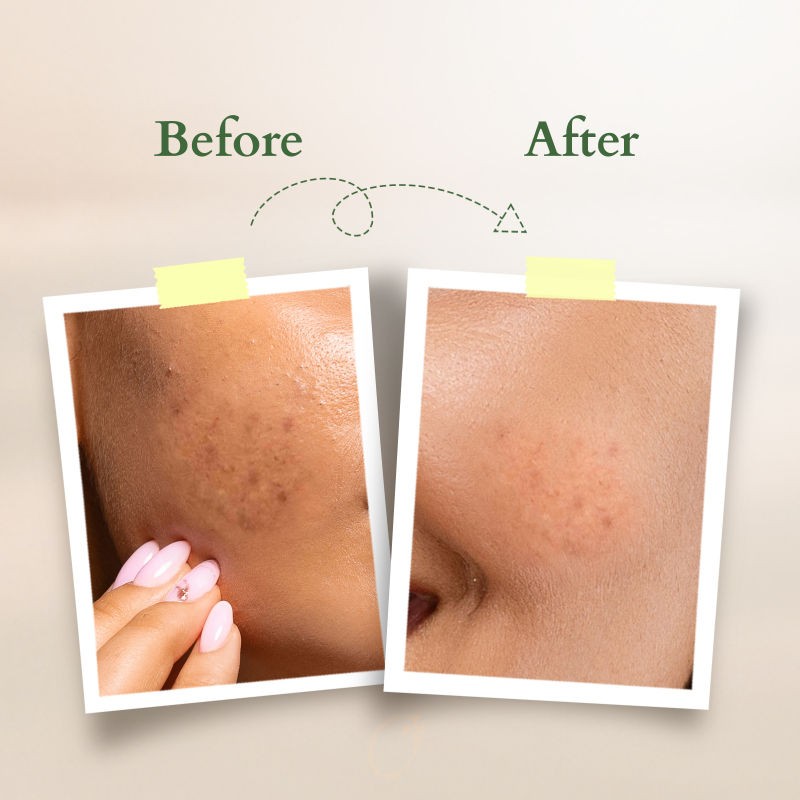 Vit-C Radiance Booster Serum - Lemon Verbena