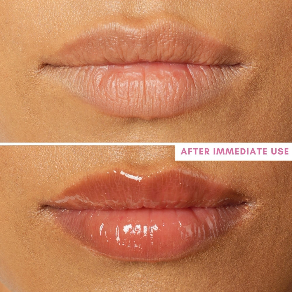 Lip Barrier Oil Clear Gloss with Peptides Hydrates, For Dry & Pigmented Lips