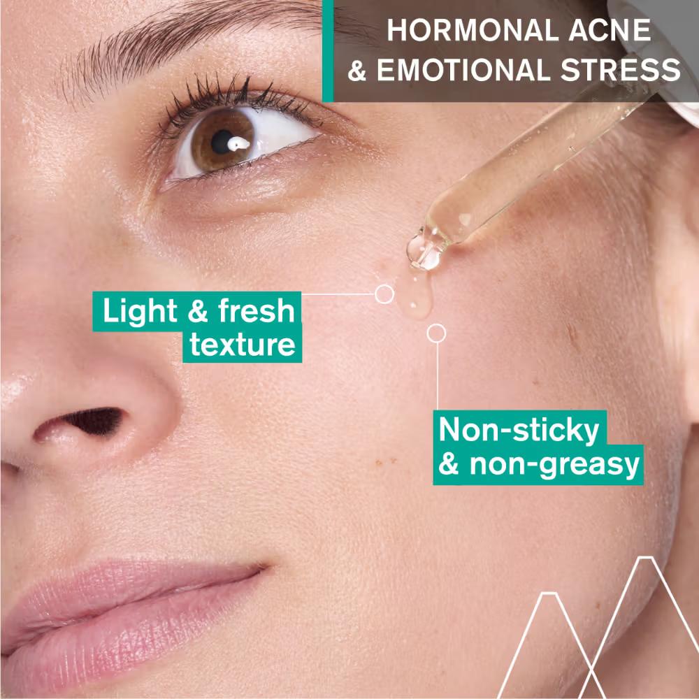 Hyseac Skin Anti-Blemish Serum 5.8% AHA for Hormonal Peak & Stress Acne Dermat Recommended