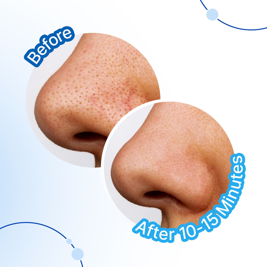 Charcoal Nose Pore Deep Cleansing Strips For Blackheads & Whiteheads Removal