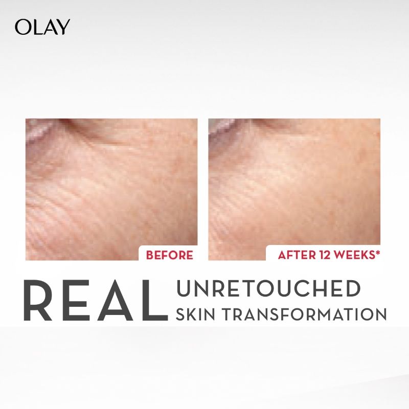Collagen Peptide Face Serum, Smooth & Plump Skin With Collagen & Niacinamide, Sulphate Free