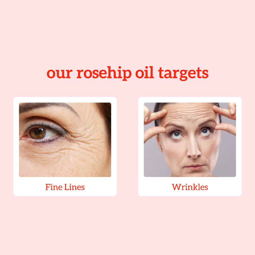 Rosehip Oil, 100% Pure & Cold Pressed, Moisturizing, Anti-Aging & Hydrating Facial Oil