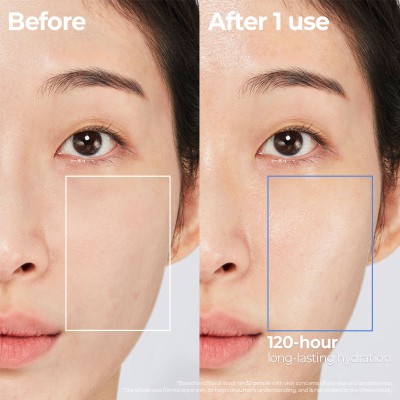 Atobarrier365 Cream
