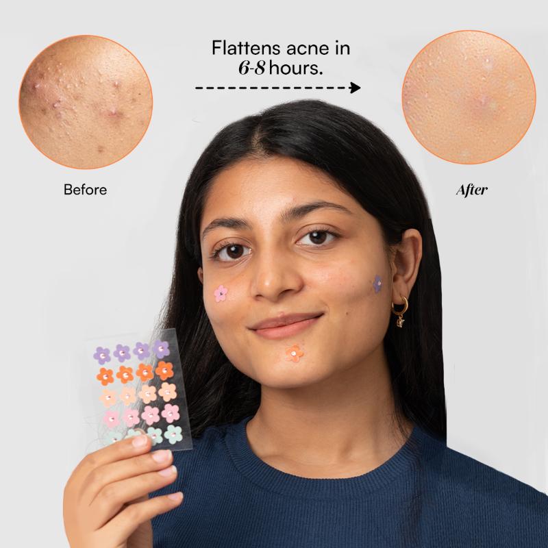 Dart It Hydrocolloid Pimple Patches - Baby Pink Heart And Star