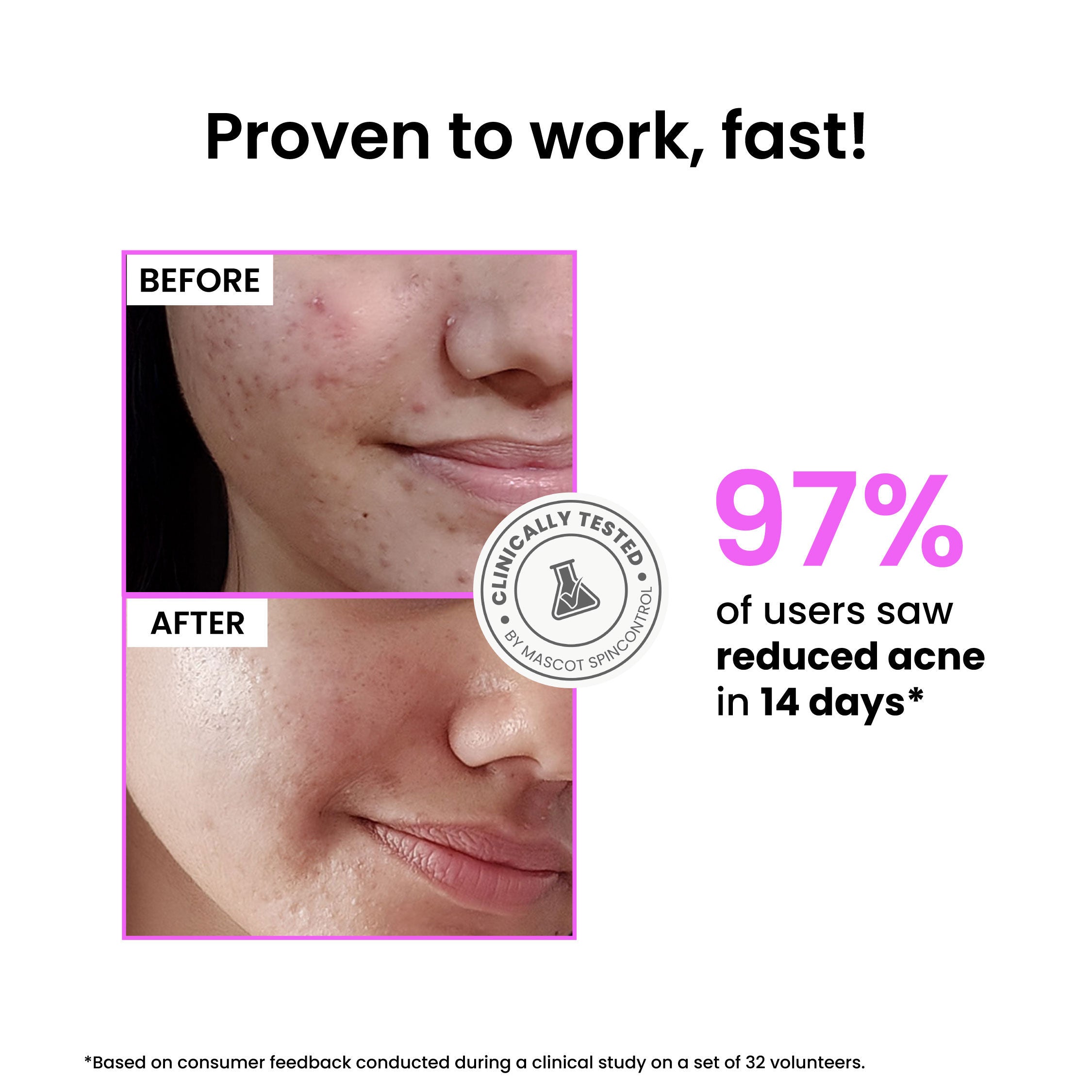 12% Niacinamide Brightening Face Serum, Fades Dark Spots, Acne marks & Oil Control
