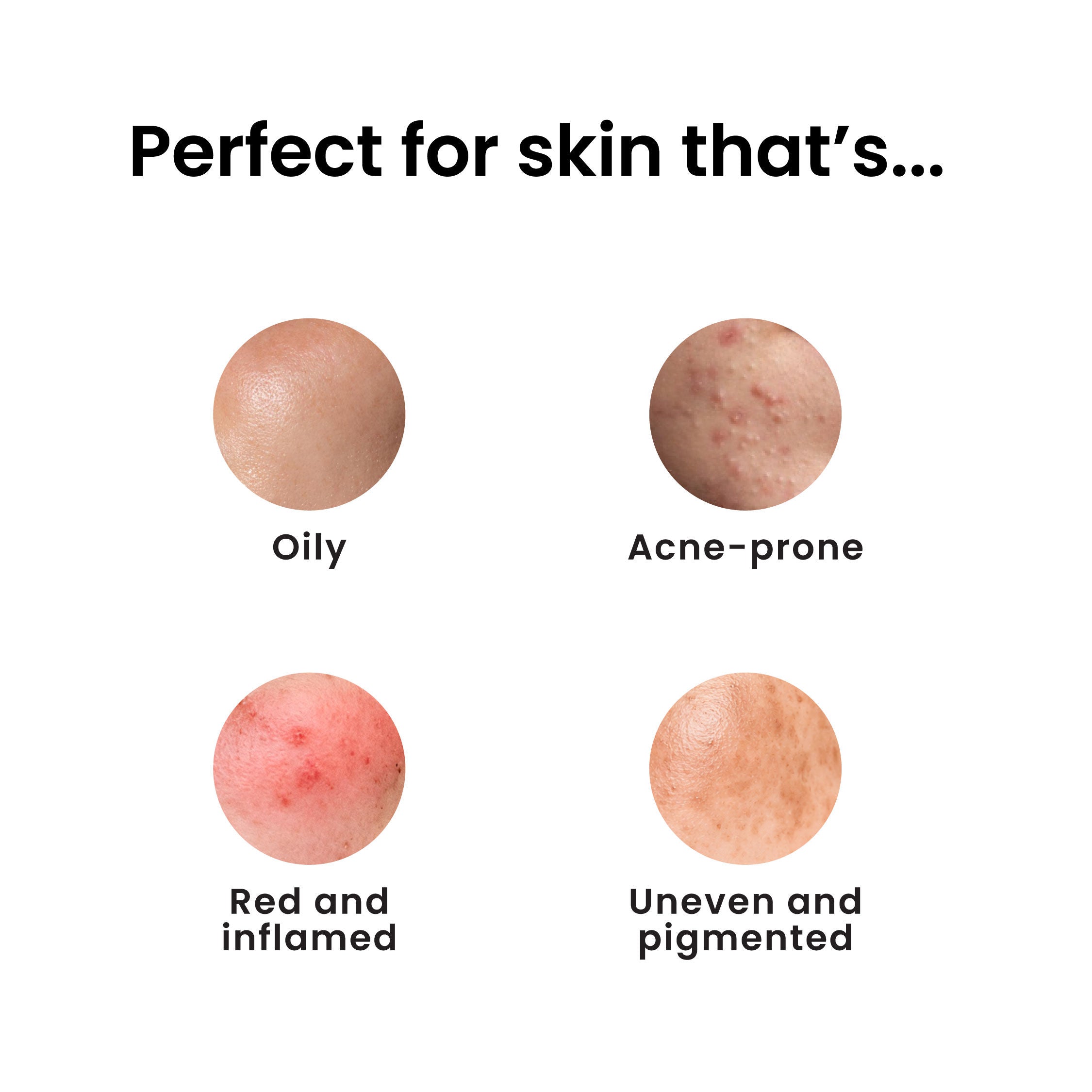 12% Niacinamide Brightening Face Serum, Fades Dark Spots, Acne marks & Oil Control