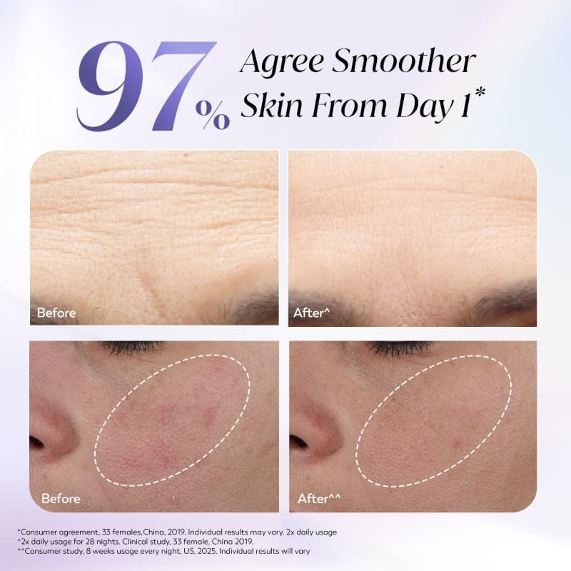 Retinol Anti Ageing Night Cream For Youthful Looking Skin, No Irritation, Fragrance Free