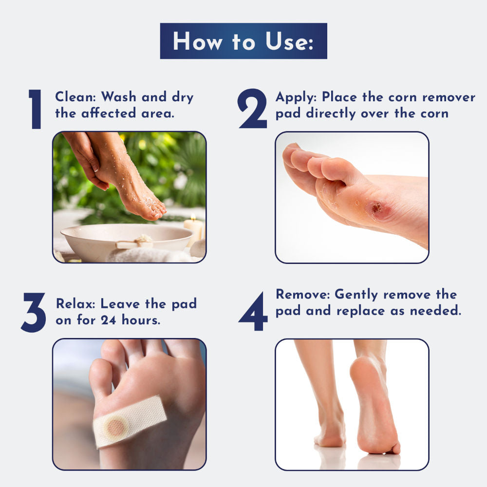 Natural Foot Corn Removal Plaster 20 Strips