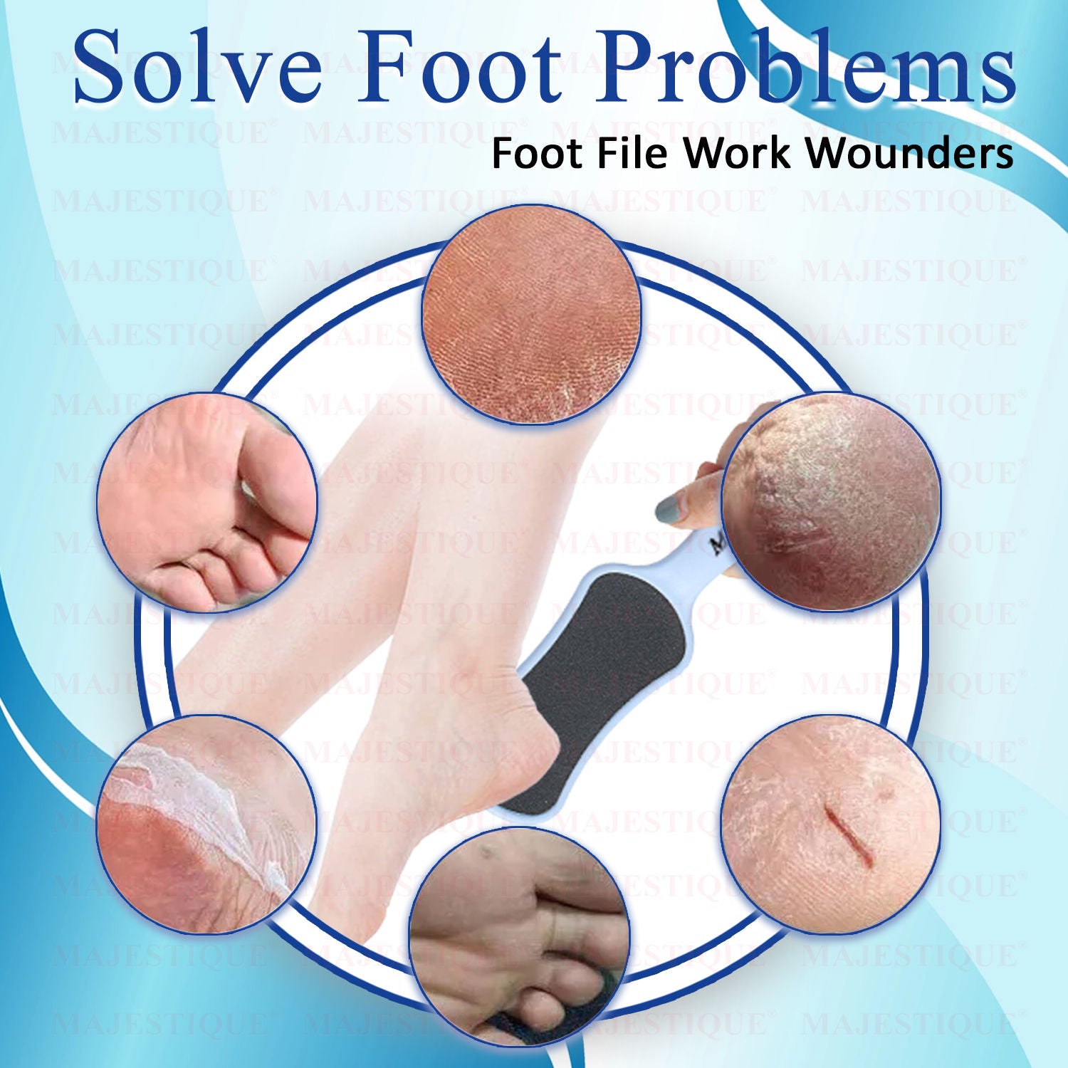 Foot Scrubber - Callus Remover & Pedicure Tool for Wet & Dry Feet - Color May Vary