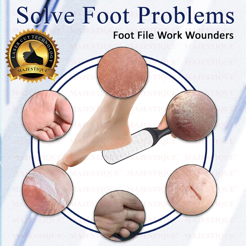 Callus Remover Foot Scrubber for Pedicure Spa Treatment - Color May Vary
