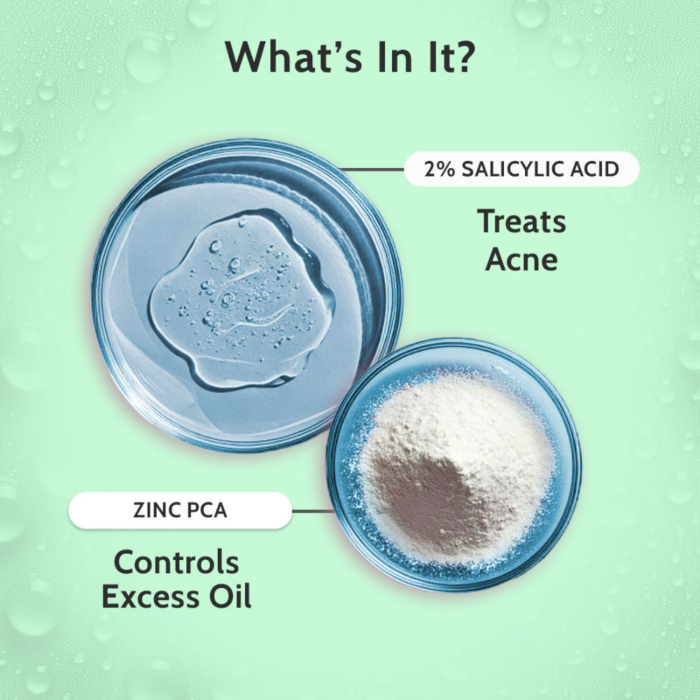 2% Salicylic Acid Face Serum Treats Active Acne, Controls Excess Oil