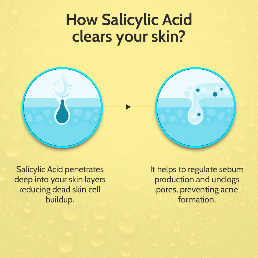 2% Salicylic Acid Face Serum Treats Active Acne, Controls Excess Oil
