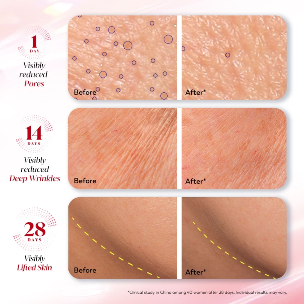 Ultra Firming Serum - Phca, Bakuchiol & Collagen Peptide