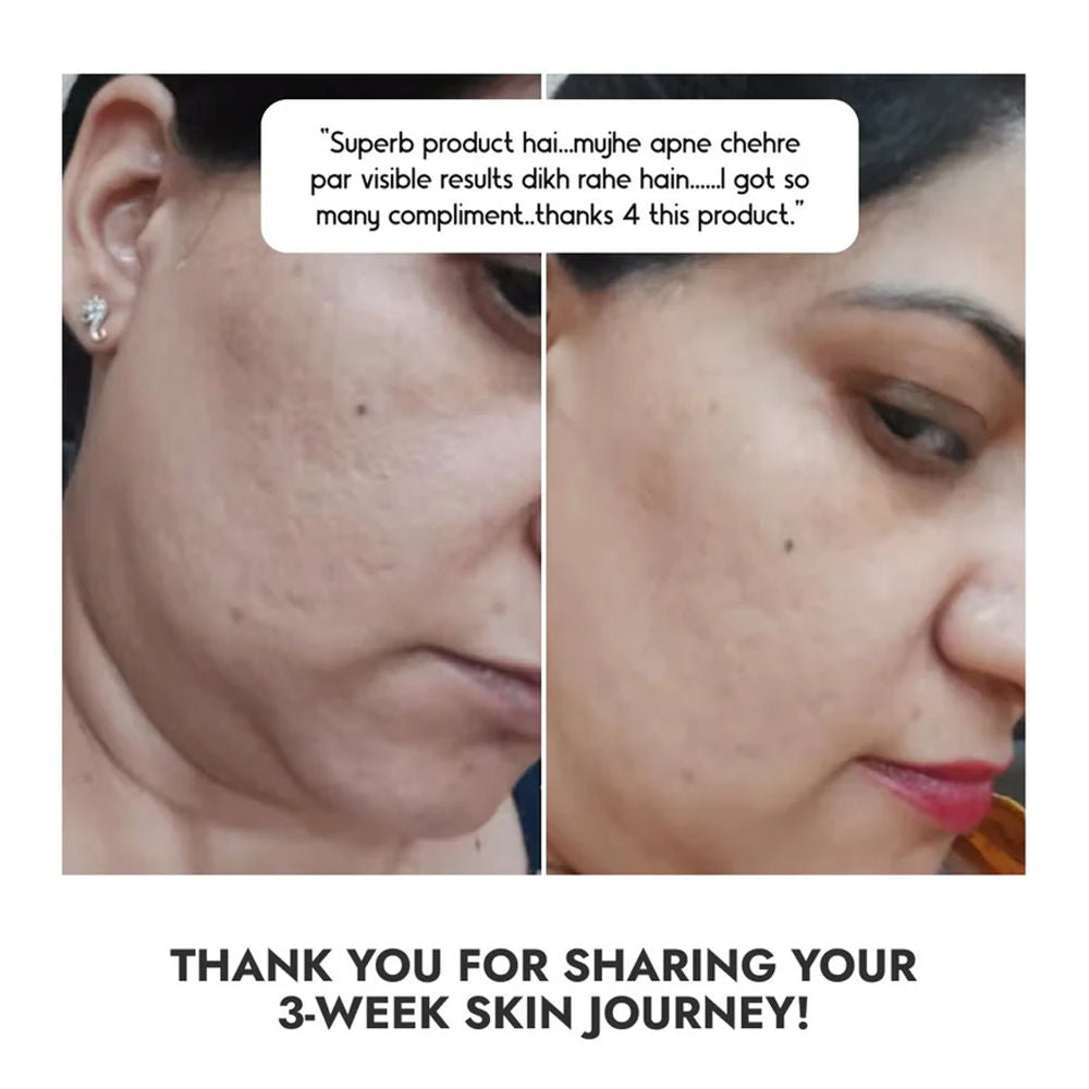 Niacinamide Vitamin B3-10% Face Serum