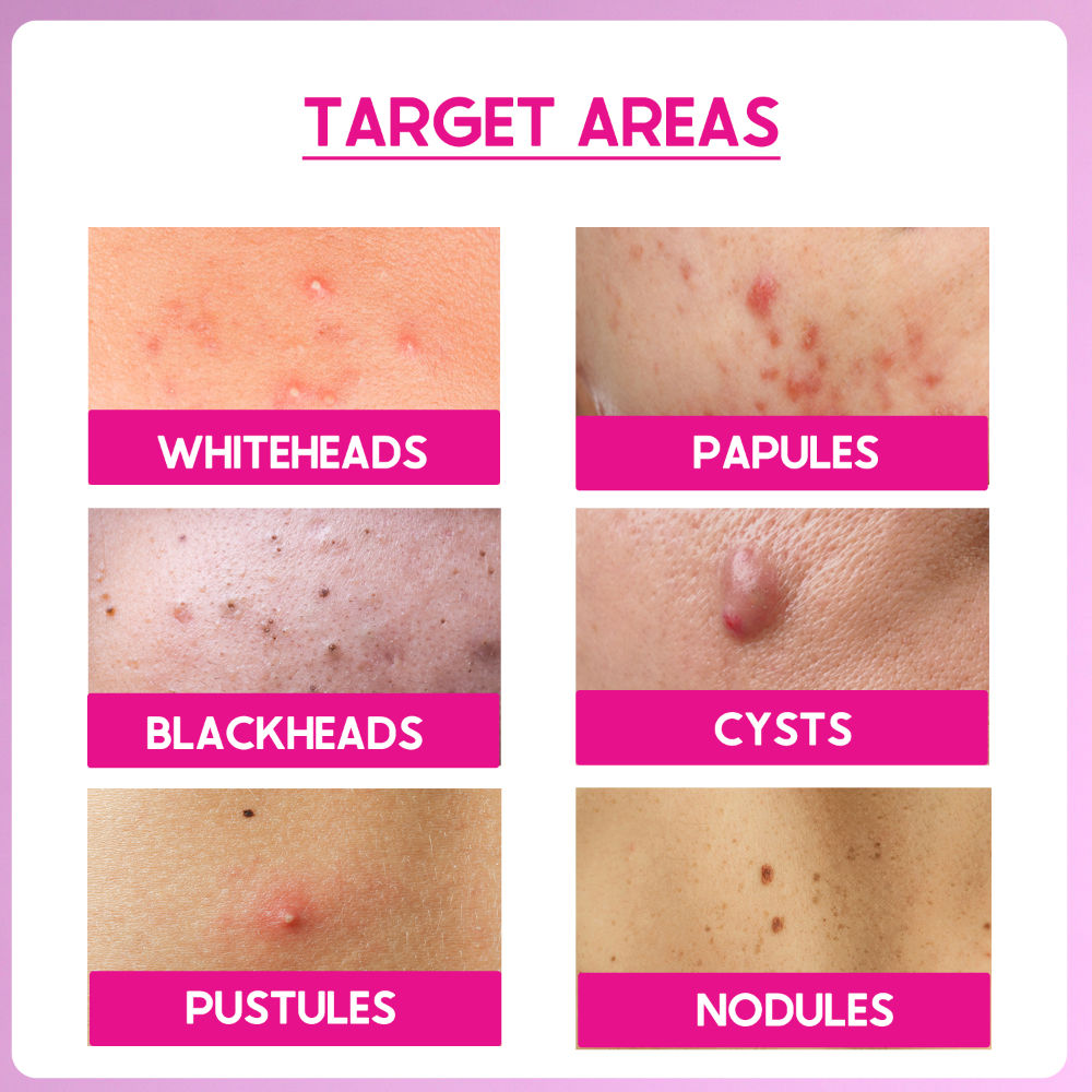 Peel ABP-22% Exfoliate AHA + BHA + PHA Beginner Friendly Serum