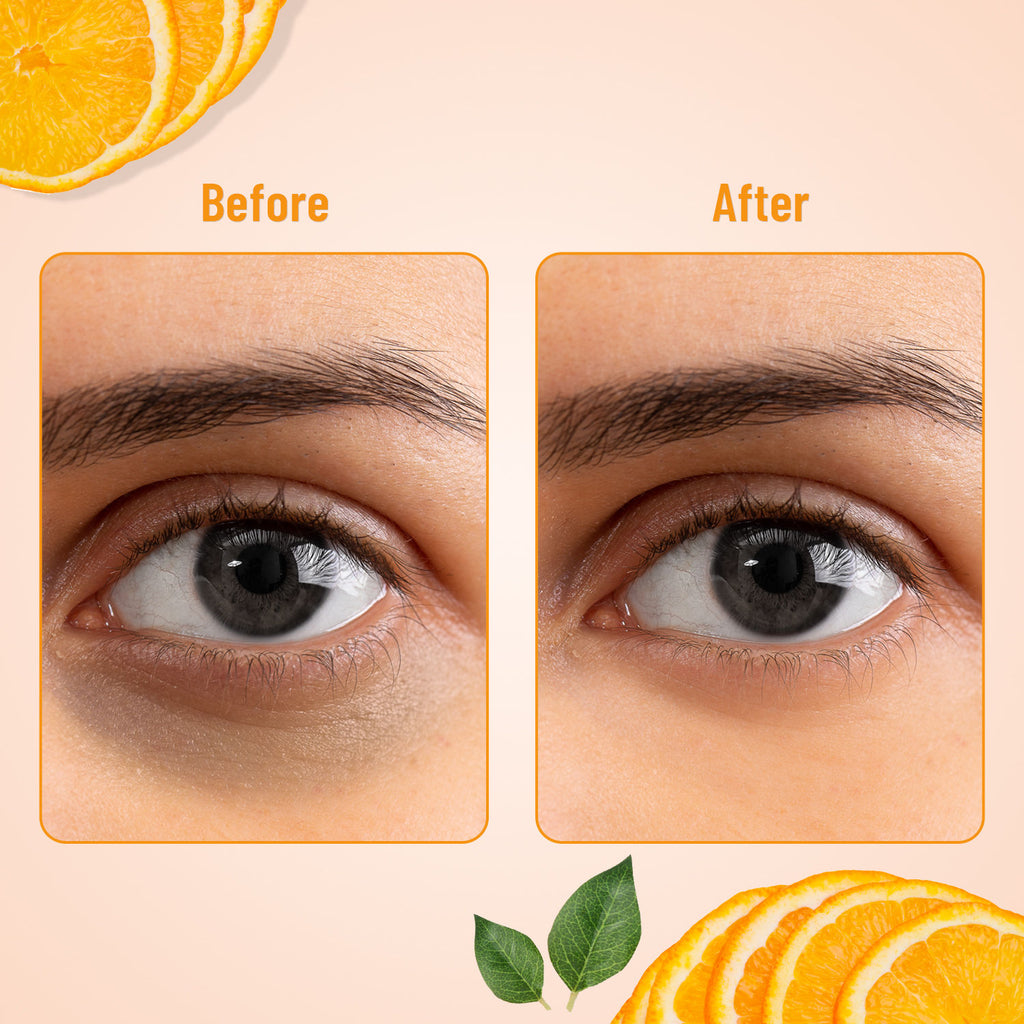 Hydra Eye Serum Patches For Dark Circles And Puffiness , Hydrate Skin