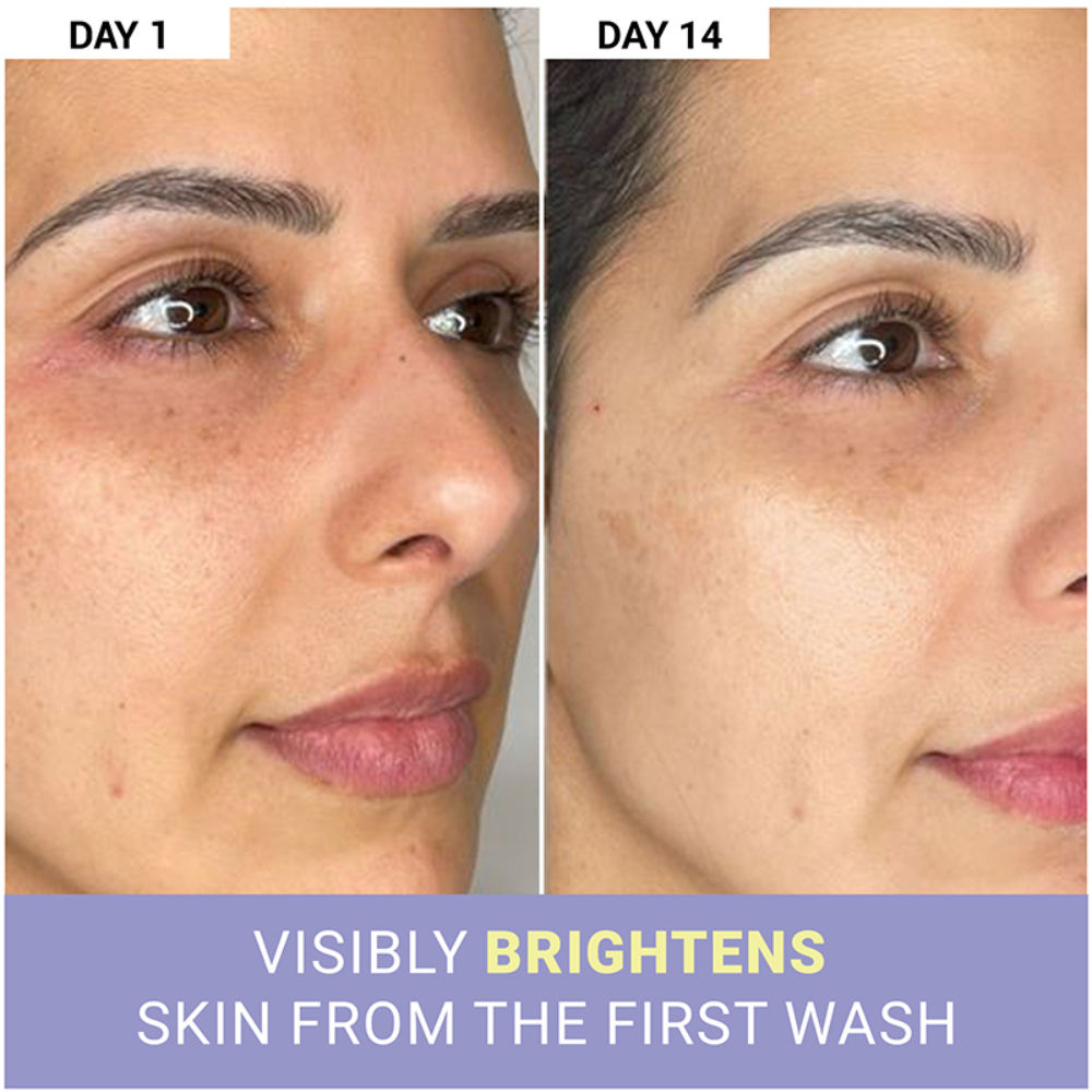 Vitamin C Clarifying Face Wash Cleanser For Brighter & Glowing Skin With Tea Tree Oil