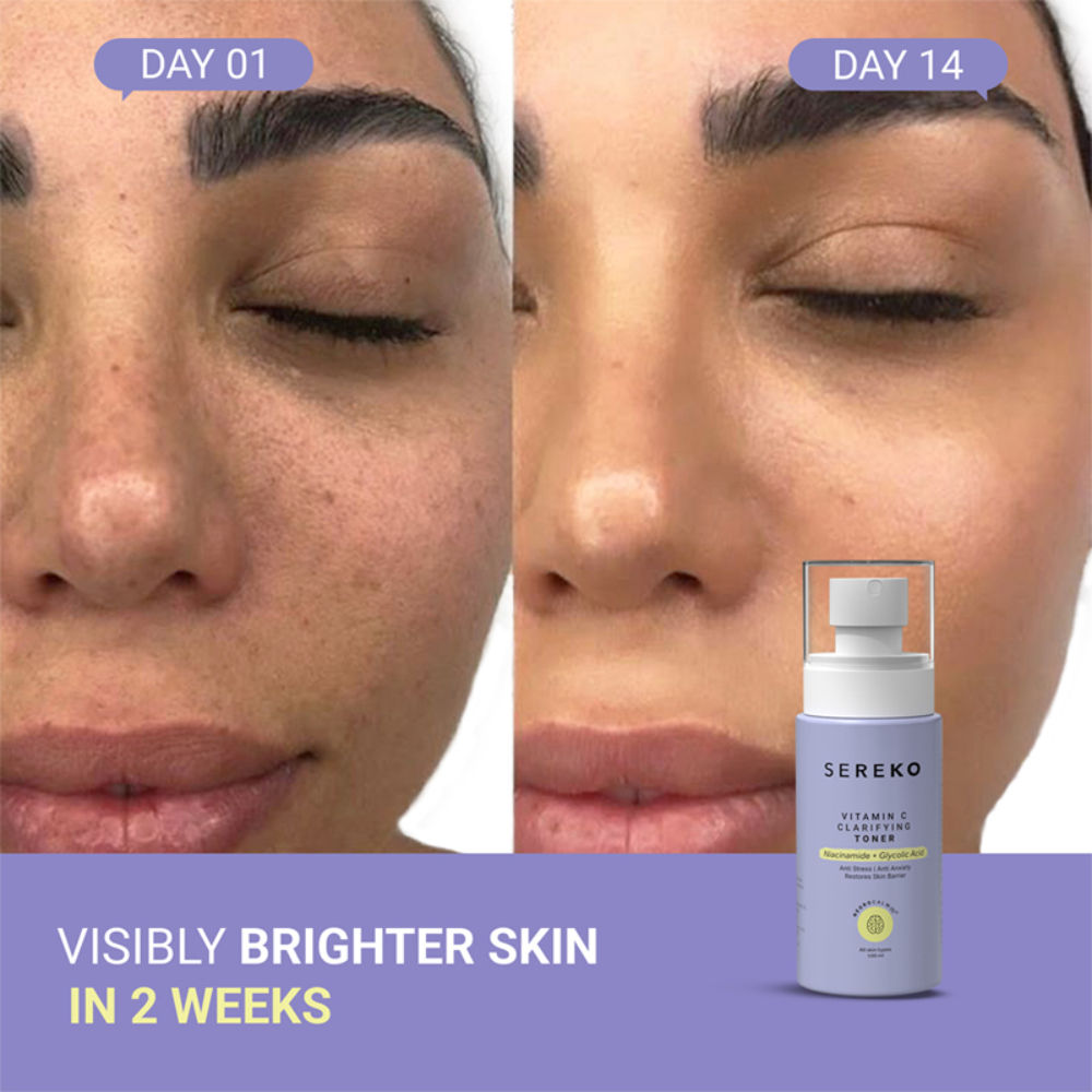Vitamin C Clarifying Face Toner With Niacinamide For Brightening & Tighten Pores