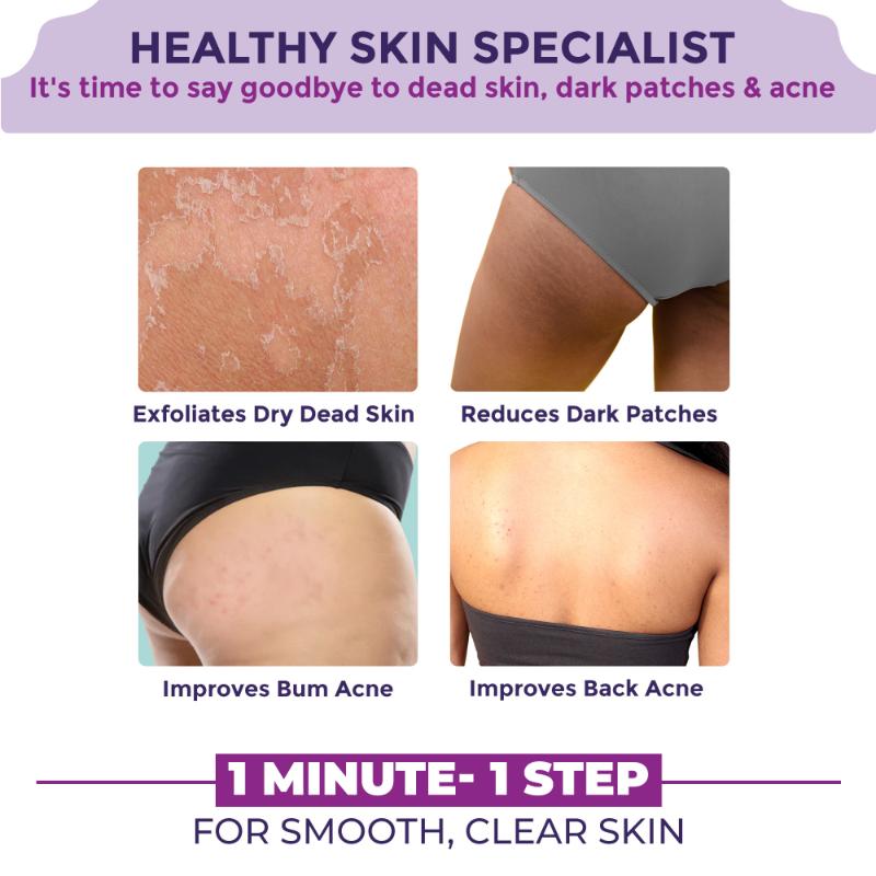 Back & Bum Cream For Dark Spots And Body Acne