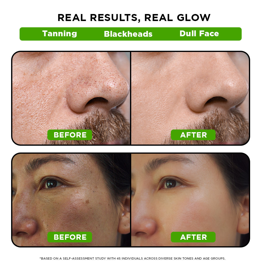De-Tan Peel Off Mask