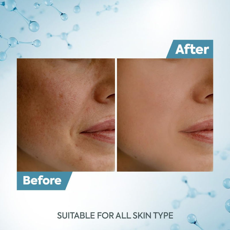 De Tan Removal Creme With Kojic & Milk(500 gm)