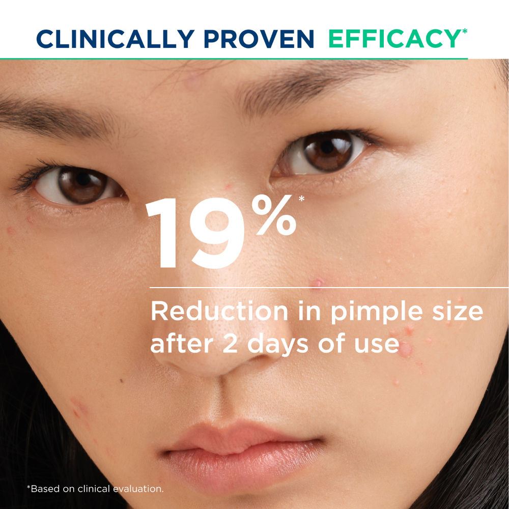 Anti-Blemish Gel Cream - Sebium Kerato+ Spot Corrector - Eliminates Pimples & Blackheads