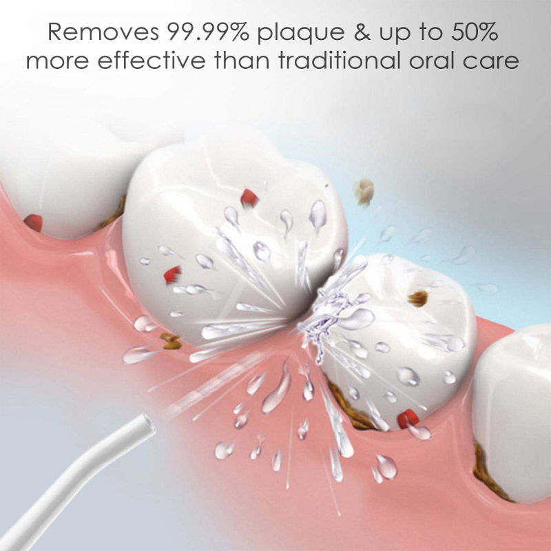 Oral Irrigator Nozzle Tip Max Tongue Cleaners