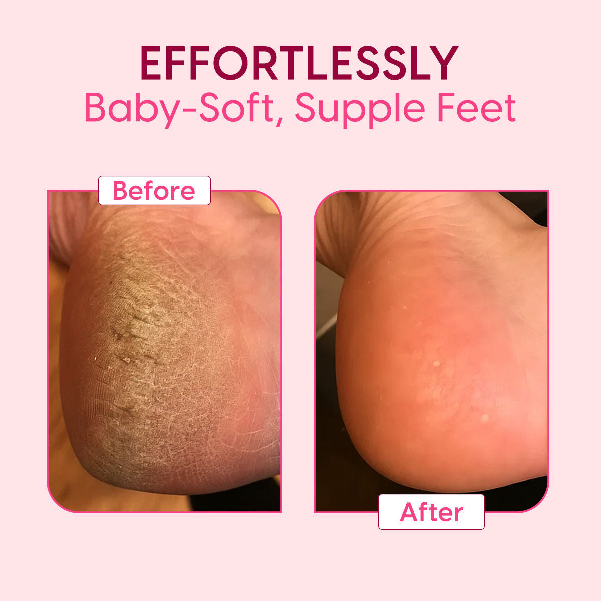 Callus Remover Electric Foot Filer Exfoliator Rechargeable Soft Feet Scrubber Pedicure Tool