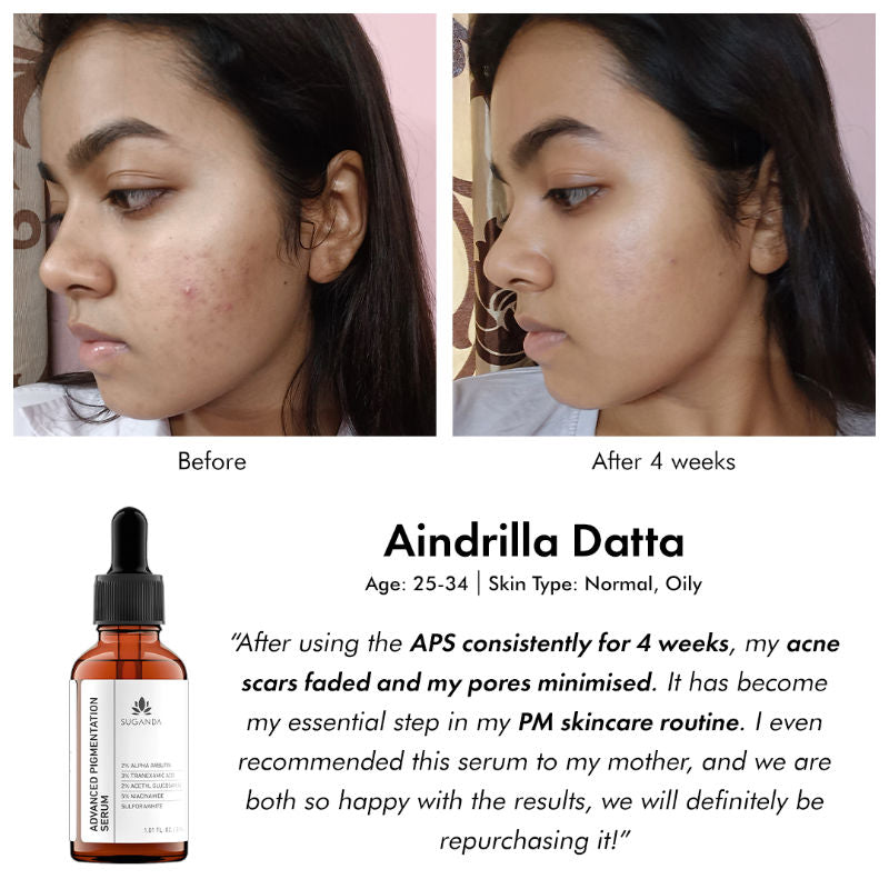 Advance Pigmentation Face Serum with Arbutin +Tranexamic Acid, Fights Hyperpigmentation