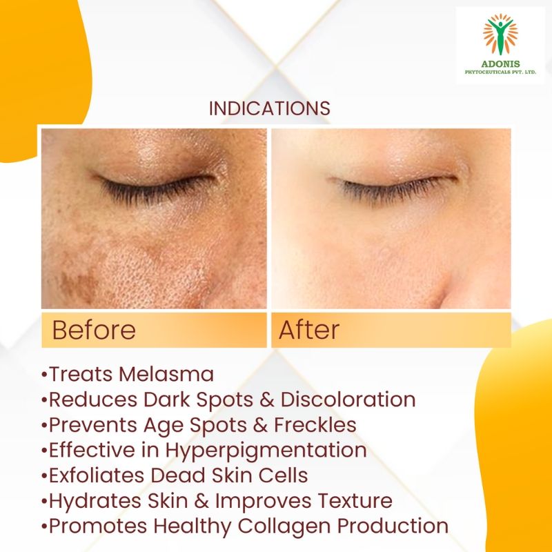 Unisex Ad Mela Tx Face Serum With Tranexamic Acid & Kojic Acid For Dark Spots & Even Tone