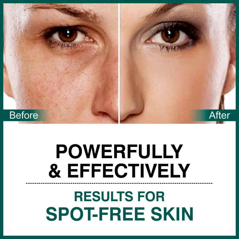 Dark Spot Corrector Cream, Niacinamide & Vitamin E Oil