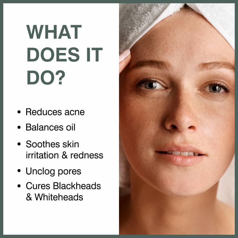 2% Salicylic Acid Serum For Face For Active Acne