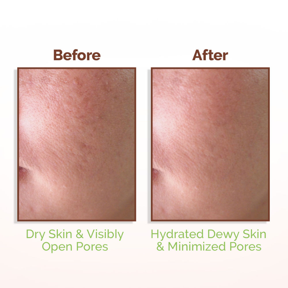 Rice Water Dewy Face Toner with 4% Niacinamide for Glass Skin and All Skin Types