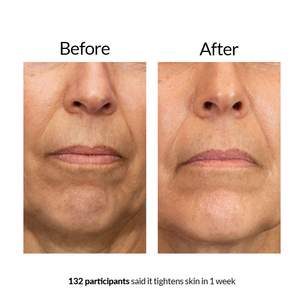 Anew Platinum Lift & Tighten Lifting Serum