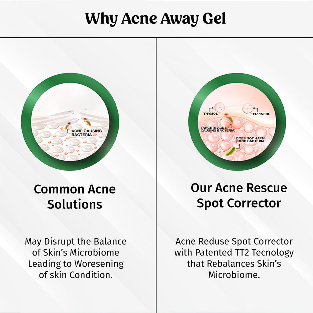 Acne Away Gel Anti Acne Face Gel