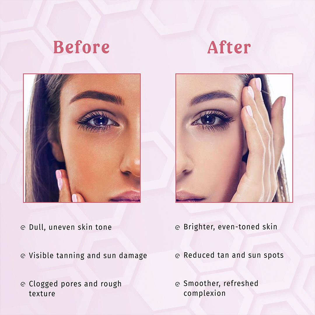 Clay And Glow -Pink Clay Facial Mask