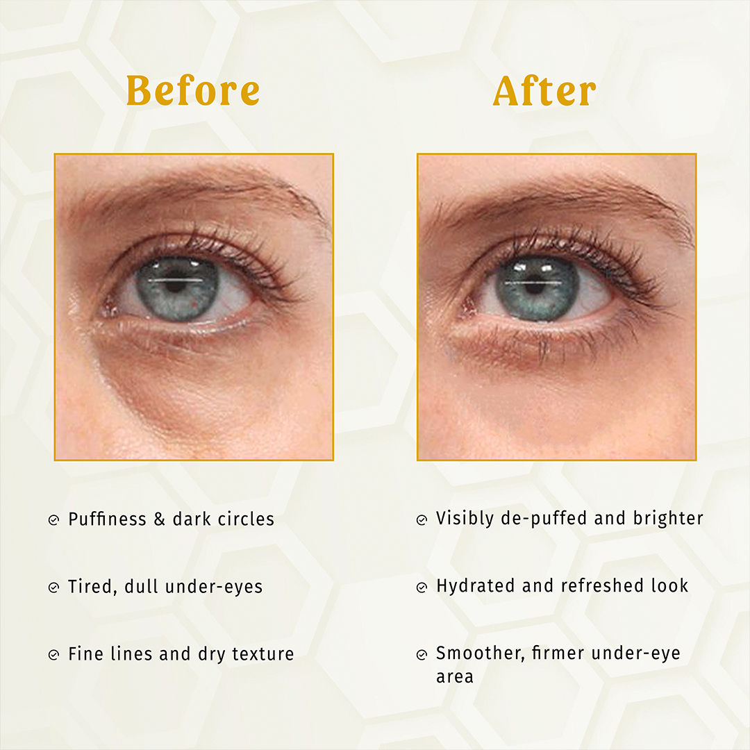 Gold E-Care Gel Eye Mask Reduces Dark Circles Hydrating, Brightening