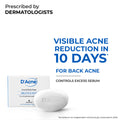 Body & Face Soap for Acne-Prone and Oily Skin, Visible Acne Reduction in 10 Days