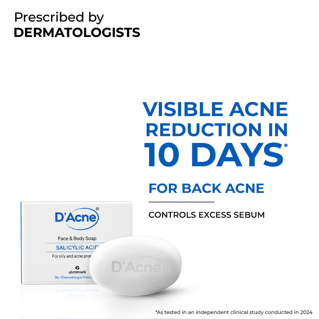 Body & Face Soap for Acne-Prone and Oily Skin, Visible Acne Reduction in 10 Days