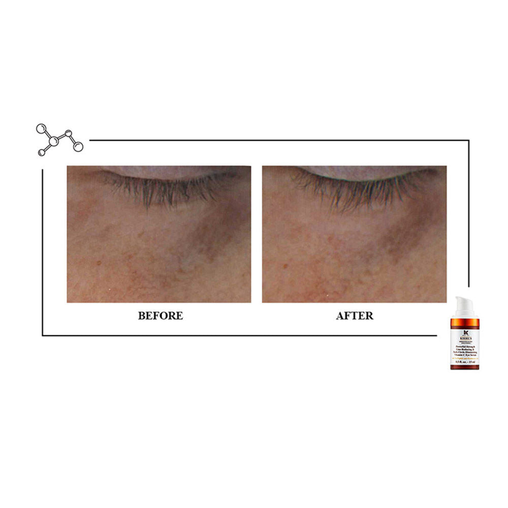 Powerful - Strength Line - Reducing & Dark Circle diminishing Vitamin C Eye Serum
