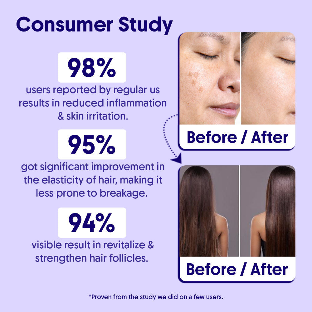 100% Pure Lavender Essential Oil For Healthy Hair Growth, Skin, & Sleep