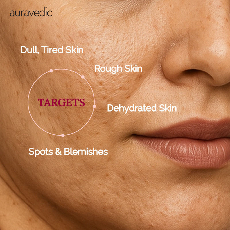 Kumkumadi Face Cream With Kumkumadi Tailam Kumkumadi Face Oil Pigmentation Cream