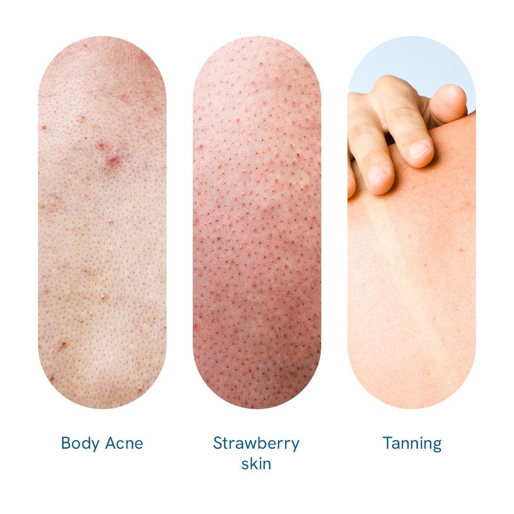 12% Aha Body Scrub - Advanced Formulation With 2% Glycolic Acid
