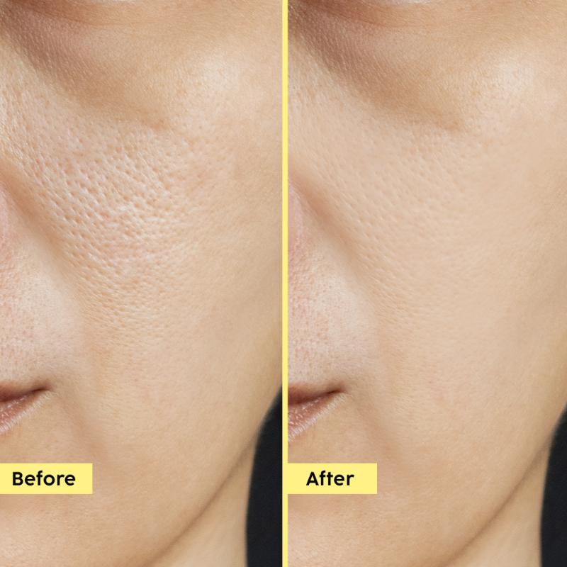 Pineapple 3% Hyloglo PHA Alcohol Free Face Toner