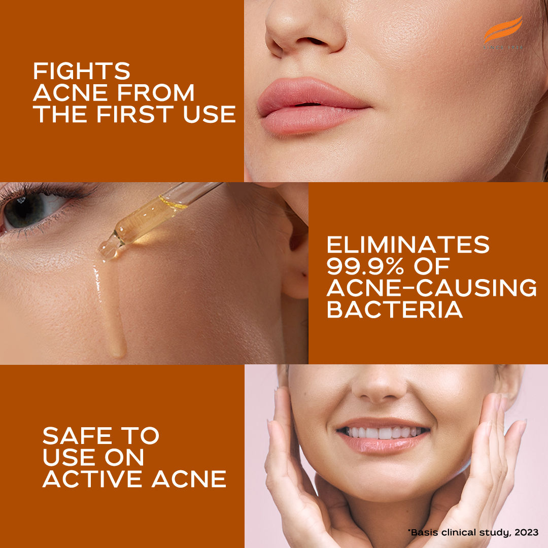 Acne Clear+ Scar Removal Serum with 2% Natural Salicylic Acid Reducing Acne & Pigmentation