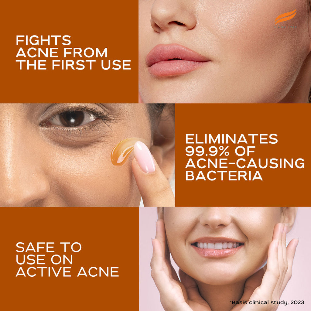 Acne Clear+ Moisturizing Gel with Natural Salicylic Acid For Active Acne & Oily Skin