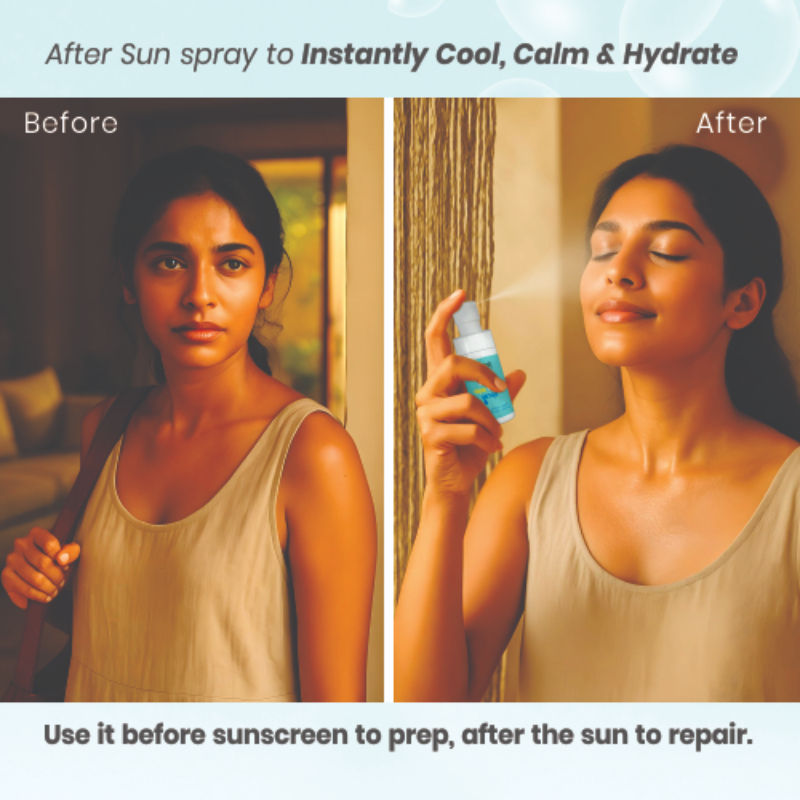 Khus Sun Care Mist