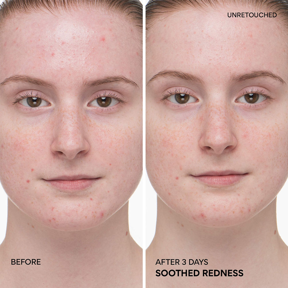 Green Tea Ceramide Milky Toner, Instant Hydration Barrier Repair in 3 Days