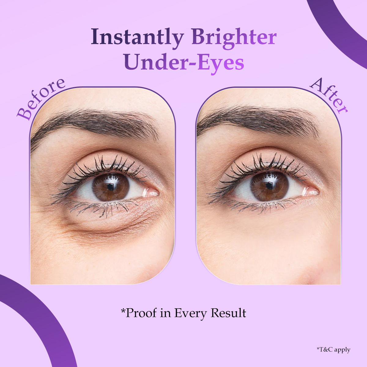 Dermalift Under Eye Therapy Patches
